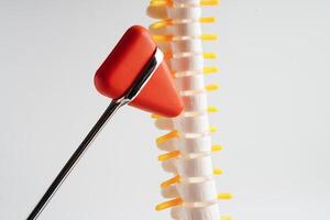 spinal nerv och ben med knä reflex hammare, länd- ryggrad fördrivna herniated skiva fragment, modell för behandling medicinsk i de ortopedisk avdelning. foto