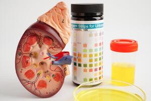 urinprov, njure och urin kopp för kolla upp hälsa undersökning i laboratorium. foto
