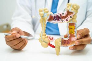 inälvor, bilaga och matsmältnings systemet, läkare innehav anatomi modell för studie diagnos och behandling i sjukhus. foto