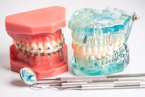dental implantera, artificiell tand rötter in i käke, rot kanal av dental behandling, gummi sjukdom, tänder modell för tandläkare studerar handla om tandvård. foto