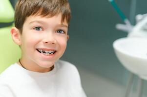 de pojke skär ett ortodontisk tallrik i hans mun foto