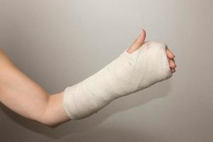 dam med bruten hand och handled insvept i gips foto