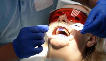 professionell tänder rengöring i en dental klinik, avlägsnande stenar och plack, applicering måla till tänder så den där en lager av stenar är synlig, särskild nyaste enheter i tandläkare, blå handskar, blå kostymer foto