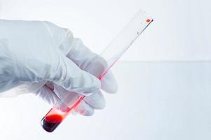 medicinskt laboratorium. en handskförsedd hand håller ett provrör med blod på en blå bakgrund. delar av en bitmappsritning. foto