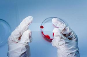 medicinskt laboratorium. en glasskiva med blod i handen i en medicinsk handske på blå bakgrund. begreppet laboratorieforskning. foto
