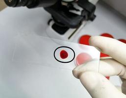 forskarens hand håller ett objektglas med en droppe blod för ytterligare laboratorietestning. foto