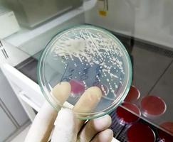 närbild av gramnegativ bakterietillväxt på hicrome uti agar med vit forskarhand som håller foto