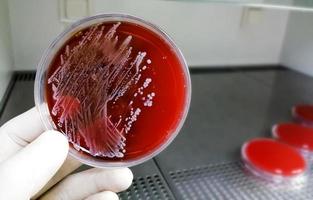 Staphylococcus aureus, grampositiv, till gramvariabel, icke-rörlig, coccus, betahemolys, saprotrofisk bakterie som tillhör familjen stafylokocktillväxt på blodagar. foto