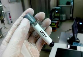 tekniker eller vetenskapsman håller ett provrör med oral glukostolerans eller ogtt-test. tre eller fem prover för diagnos av toleransen för blodsocker i kroppen. foto