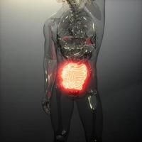 mänsklig tunntarmsröntgenundersökning foto
