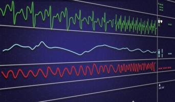 ekg-monitor i intraaorta ballongpumpmaskin i icu på oskärpa bakgrund, hjärnvågor i elektroencefalogram, pulsvåg foto