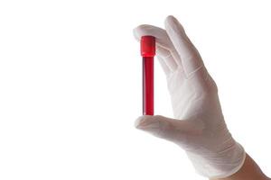 hand som håller ett glas provrör med patientens blod för testning isolerad på vit bakgrund med urklippsbana. foto