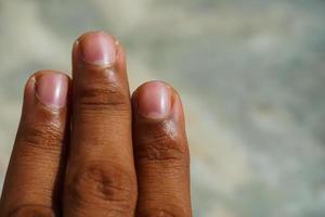 bild av fingrar där finger foto