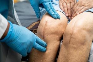asiatisk läkare injicera hyaluronsyra blodplättsrik plasma i knät på äldre kvinna för att gå utan smärta. foto