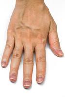 kvinna hand med blodådror isolerad på vit bakgrund. finger med mitten av digitalt hår är dominant gen. baksidan av handen hud med torr och rynkor i vuxen kvinna behöver spa eller paraffinvax behandling. foto