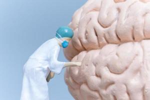 miniatyr människor kirurg analysera patientens hjärna foto