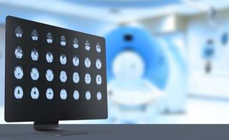 mri, ultraljud, barns hjärna på datorskärmen i ct-rummet. mjuk suddig bakgrund. medicinsk affisch. foto