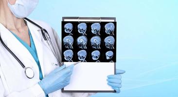en läkare i medicinska kläder och blå medicinska handskar undersöker en uppsättning MR-skanningar av ett barns hjärna i ett laboratorium. kopieringsutrymme. foto