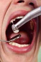 tandläkare gör behandlingsprocessen