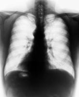 film röntgen scan human