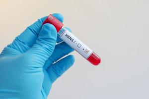 h5n1 influensavirus foto