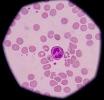 neutrofila granulocyter