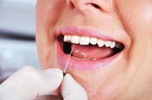 tandläkare undersöker tänderna foto