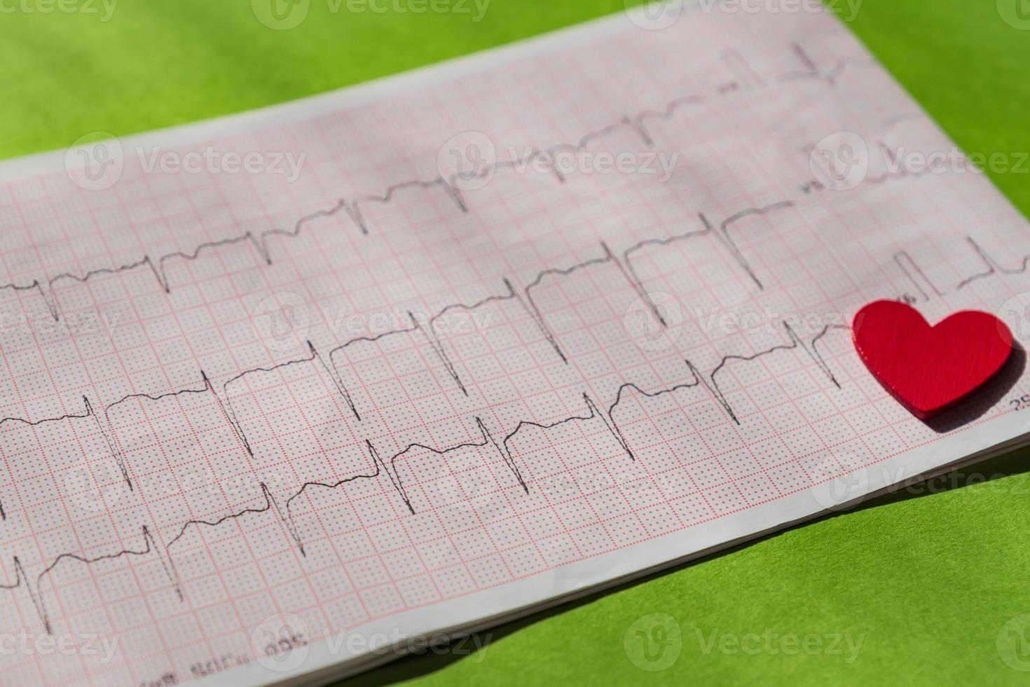 close-up van een elektrocardiogram in papieren vorm met rood houten hart. ecg of ekg papier op groene achtergrond. medisch en gezondheidszorgconcept. foto