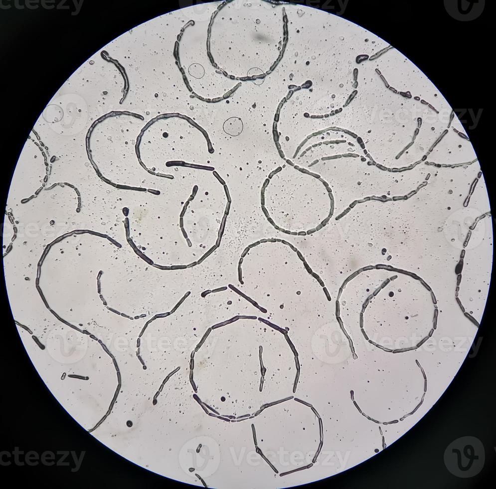microfoto tonen hyfen van dermatofyten, nagel schrapen voor schimmel test foto