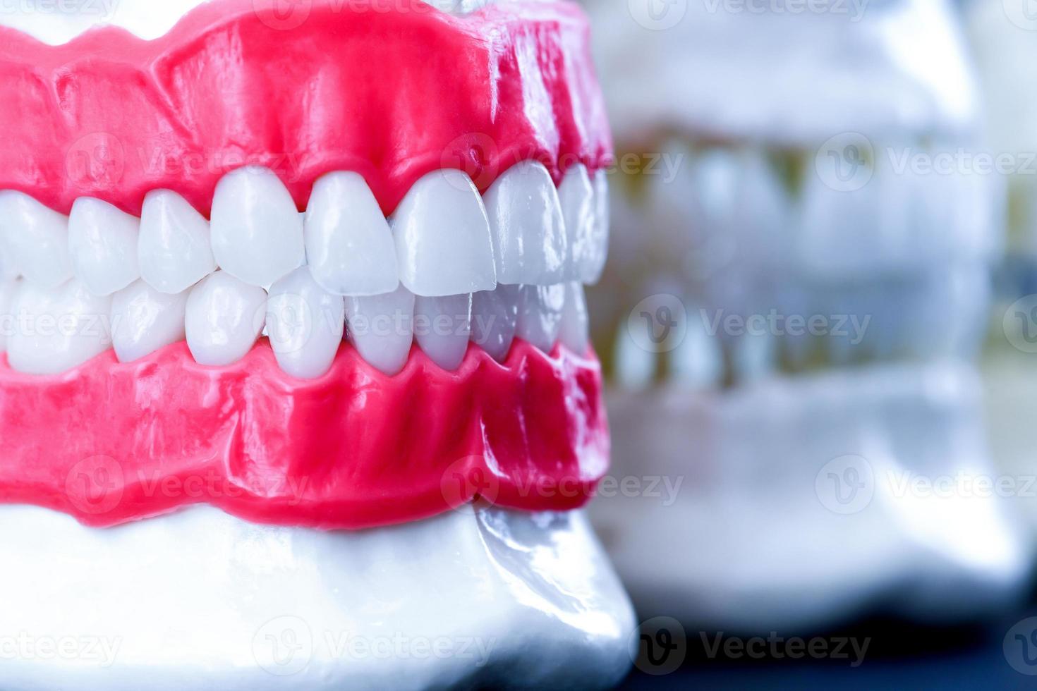 menselijk kaken met tanden en tandvlees anatomie modellen foto