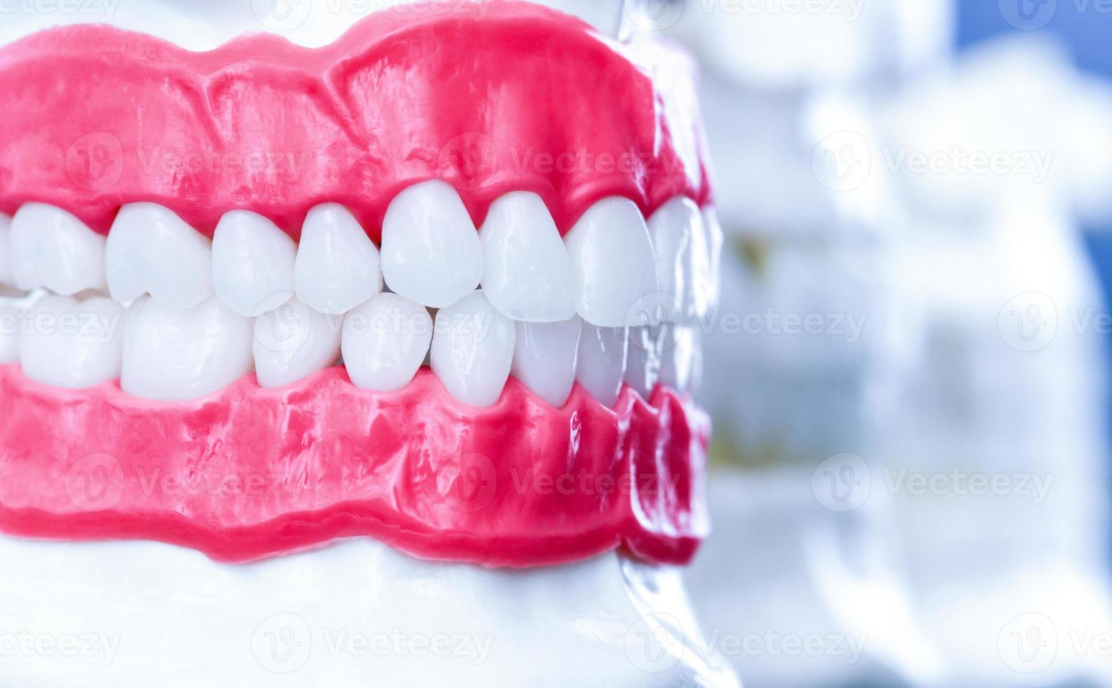 menselijk kaken met tanden en tandvlees anatomie modellen foto