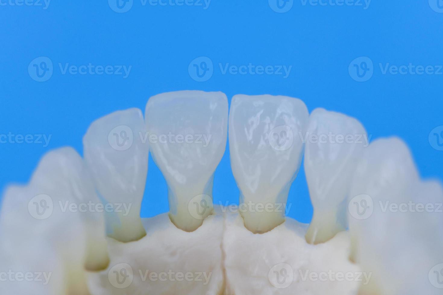 lager menselijk kaak met tanden anatomie model- foto