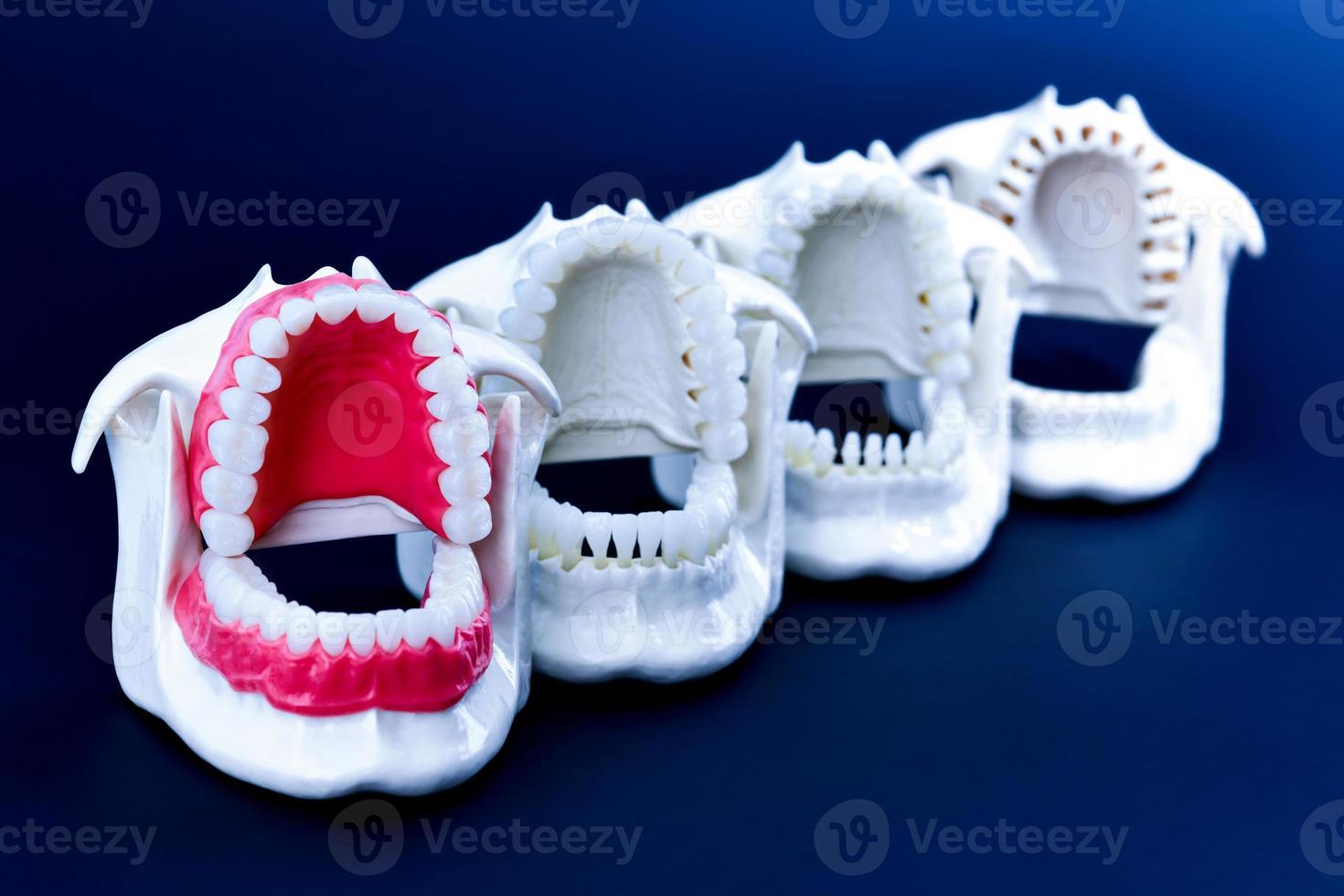 tandarts orthodontisch tanden modellen foto