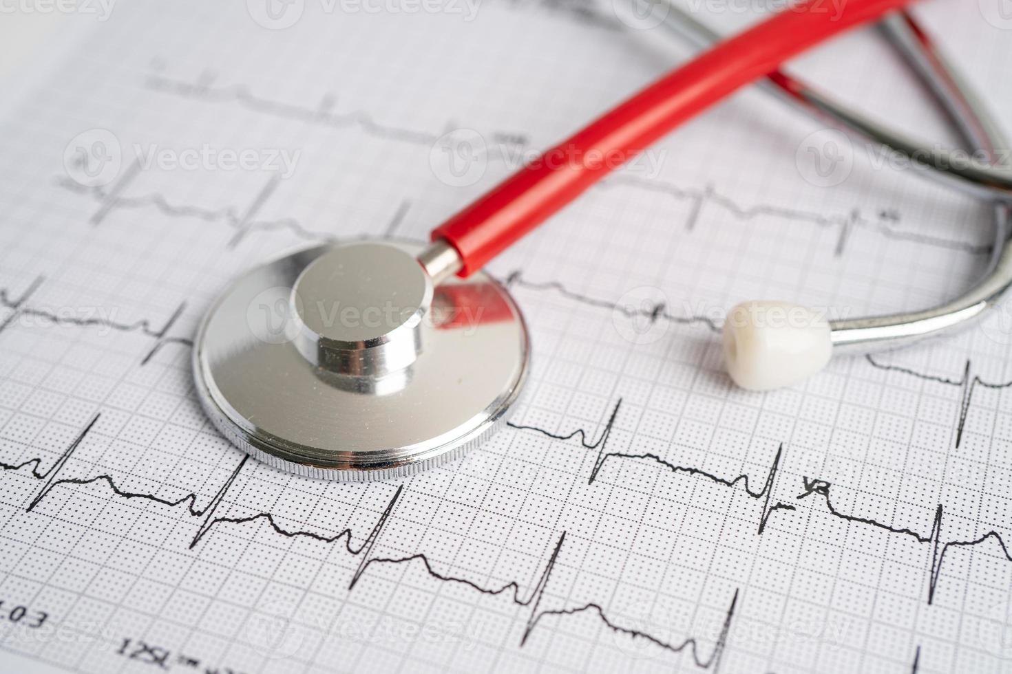 stethoscoop op elektrocardiogram ecg, hartgolf, hartaanval, cardiogramrapport. foto