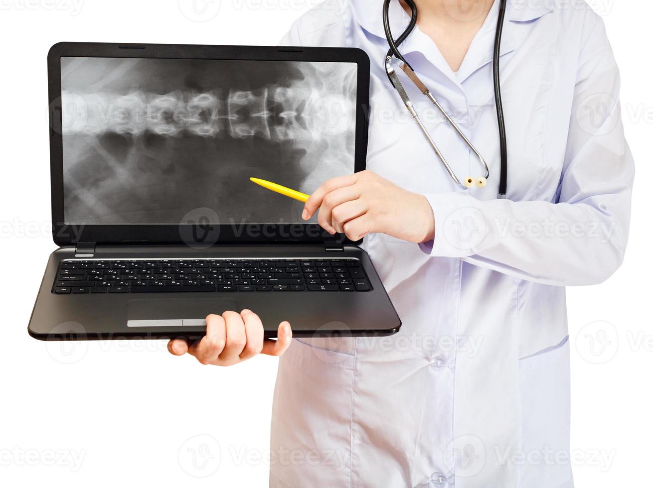 verpleegster points Aan computer laptop met spinal kolom foto