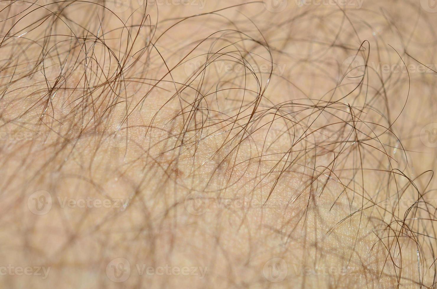 dichtbij omhoog detail van menselijk huid met haar. mans harig been foto