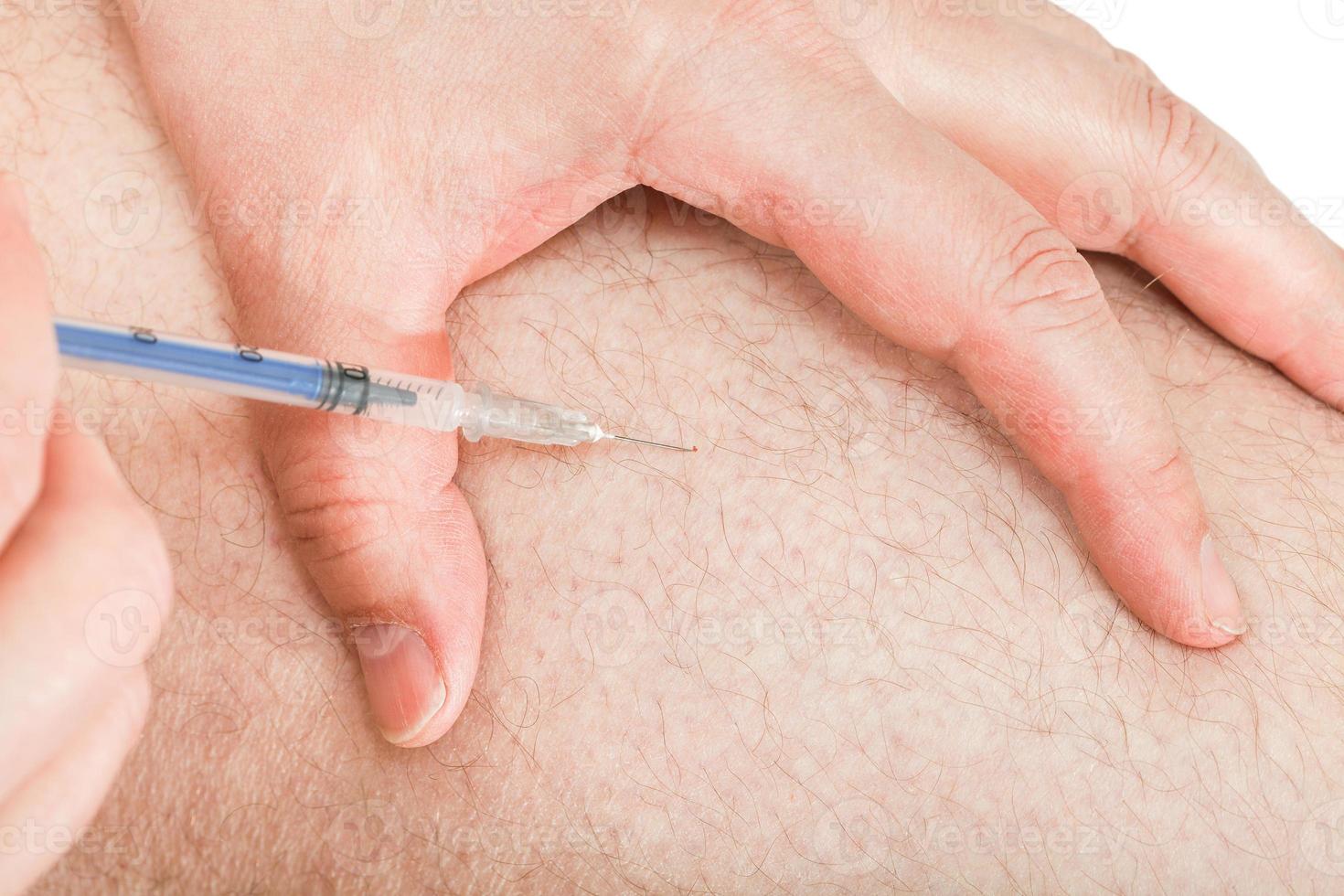 diabetisch insuline injecties in de dij foto