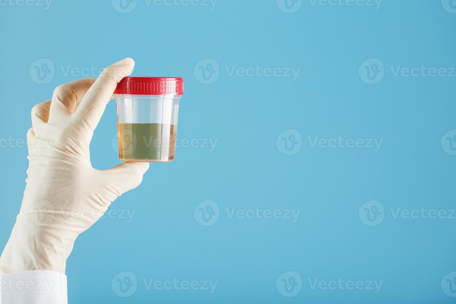 de dokter gehandschoende hand- houdt een transparant houder met een urine testen. foto