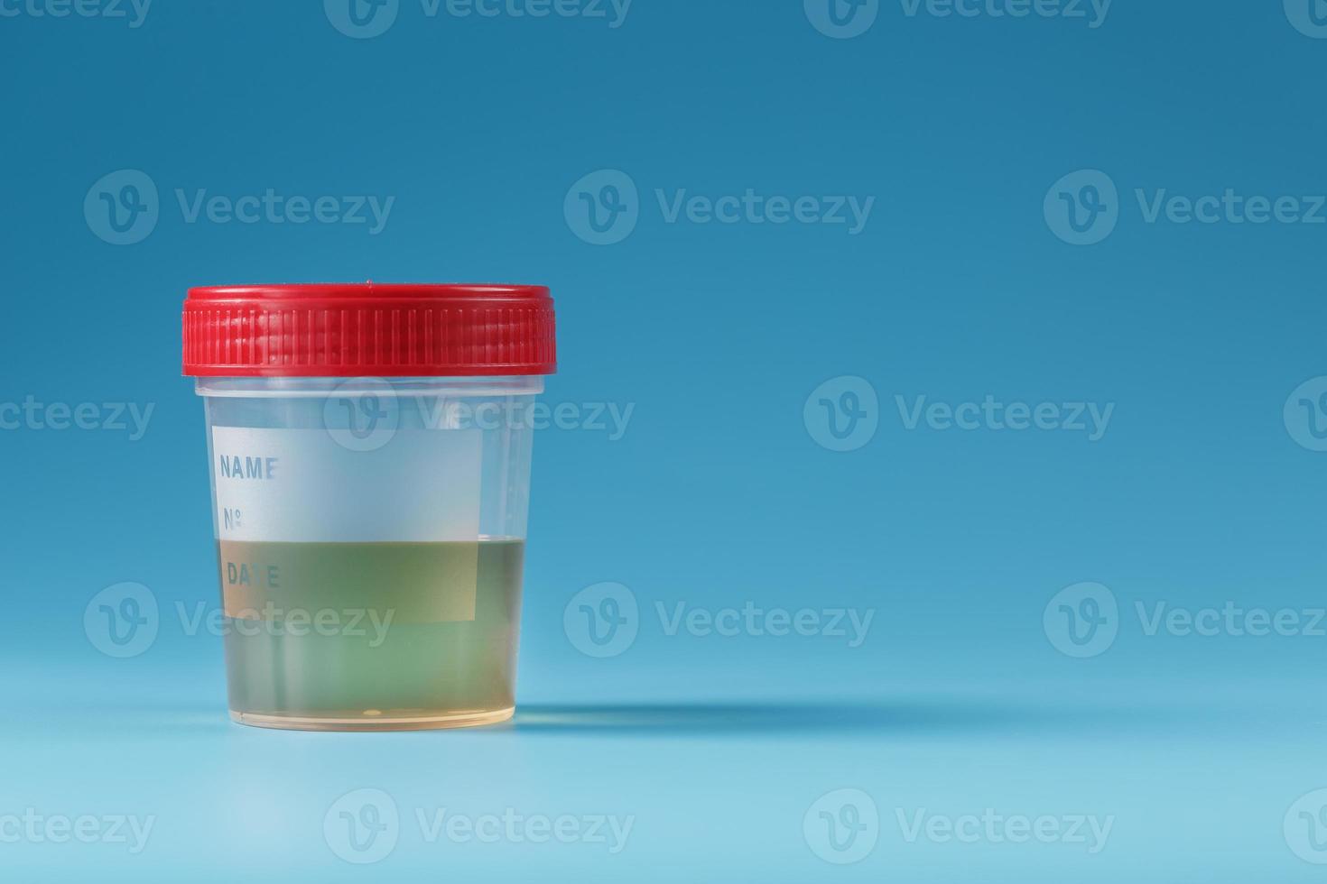 een houder voor biomaterialen met een urine analyse en een rood deksel Aan een blauw achtergrond. foto