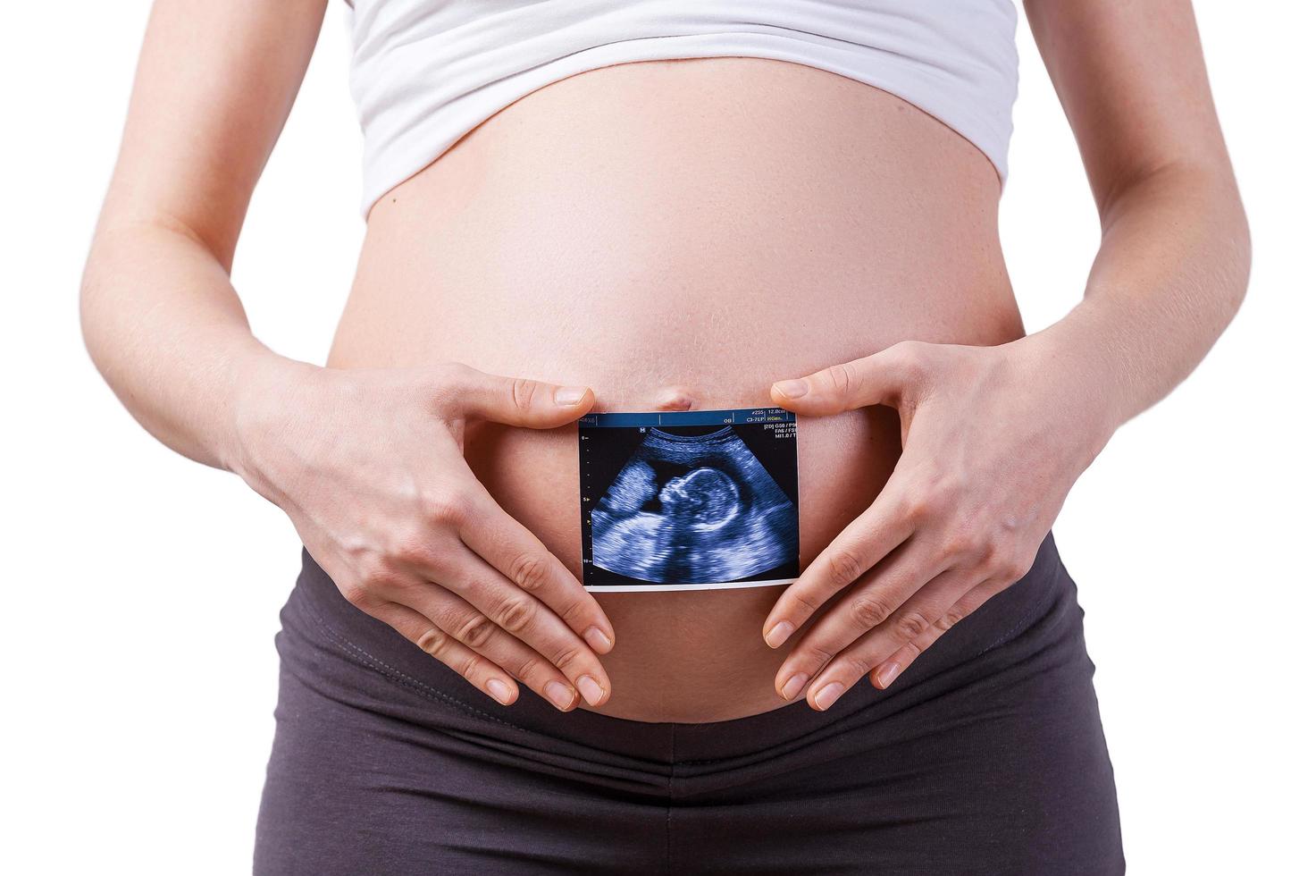 verwachting. bijgesneden beeld van zwanger vrouw Holding röntgenstraal beeld van baby terwijl staand geïsoleerd Aan wit foto