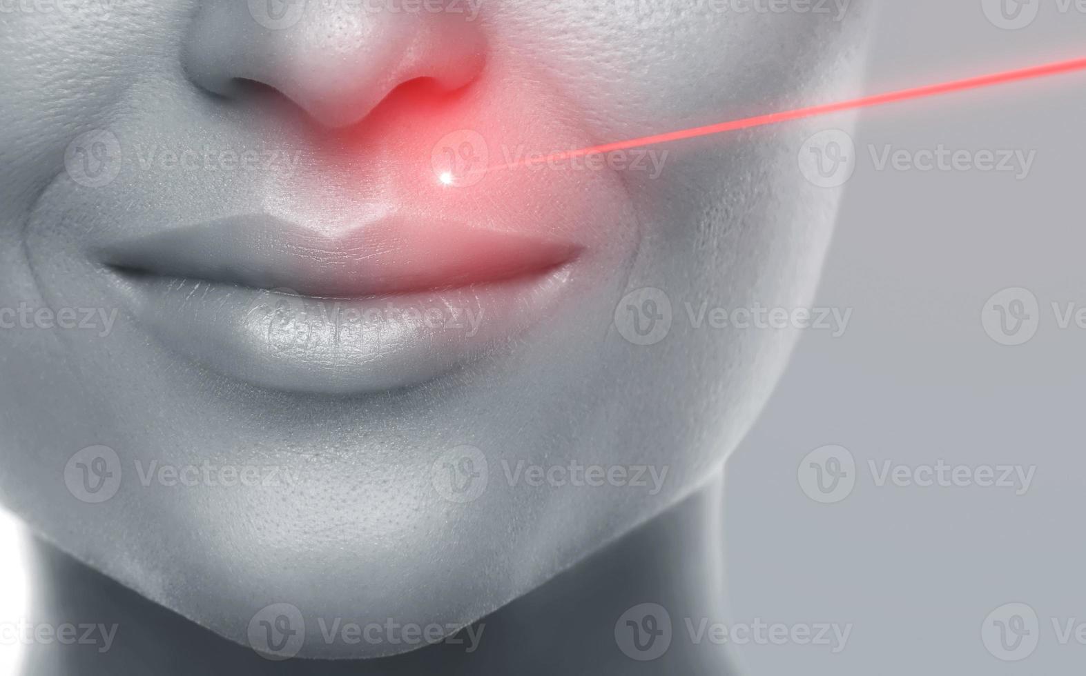 vrouw lippen en laser haar- verwijdering of huid verjonging foto