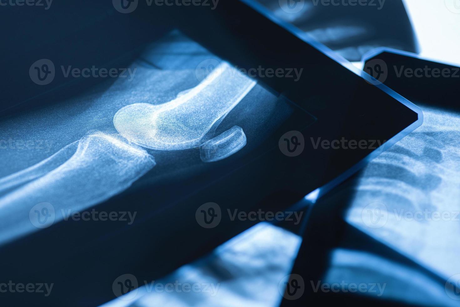 detailopname van verschillend röntgenstraal afbeeldingen Aan de tafel foto