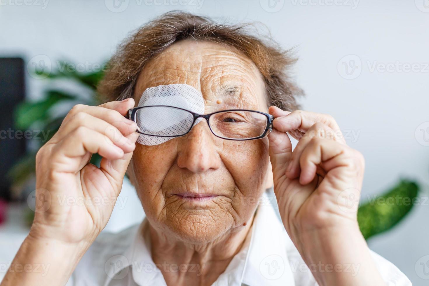 dichtbij omhoog afbeelding van een ouderen vrouw gewond oog foto