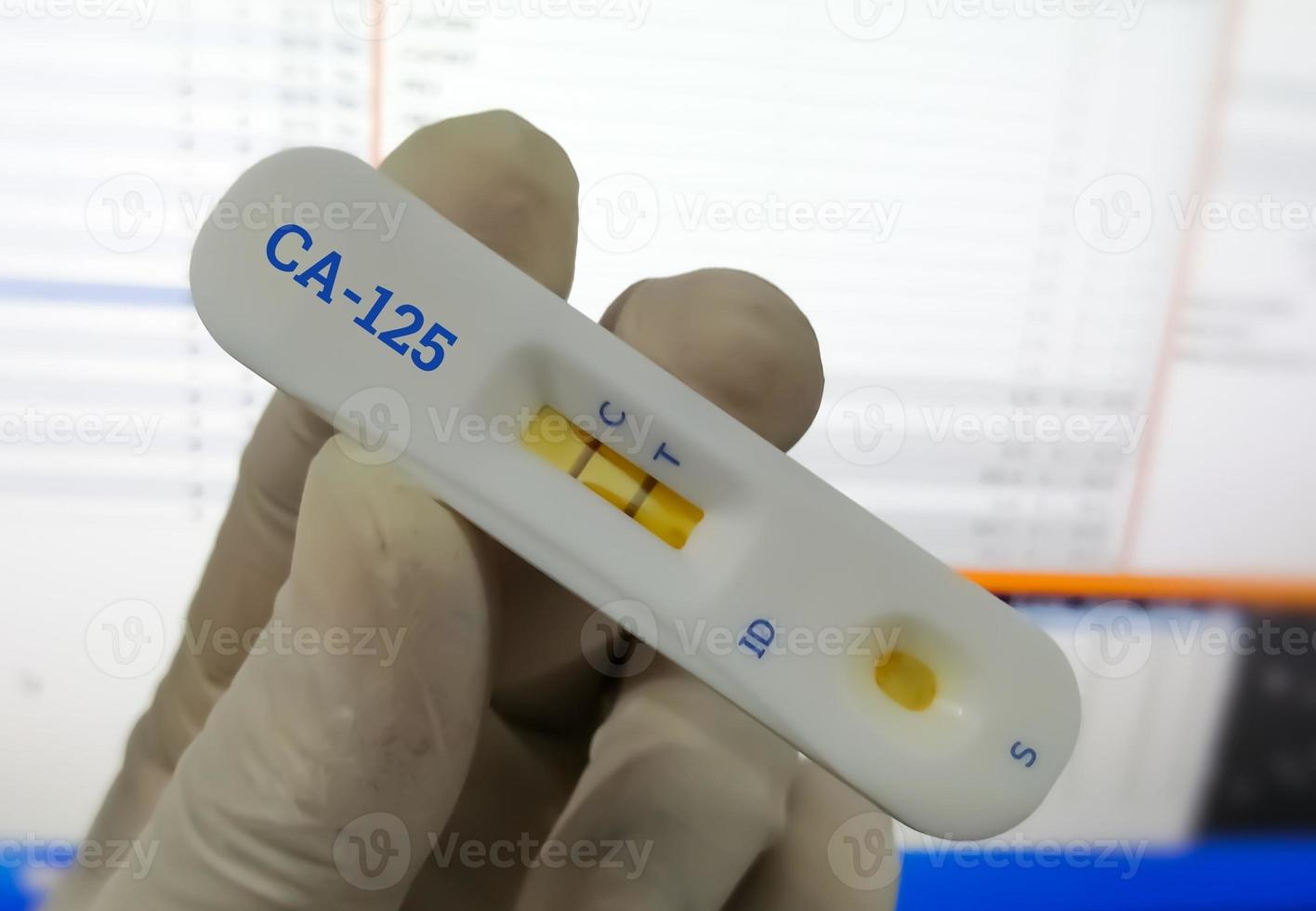 snel test cassette voor ongeveer 125 snel screening testen. tumor markeerstift voor eierstok kanker. foto