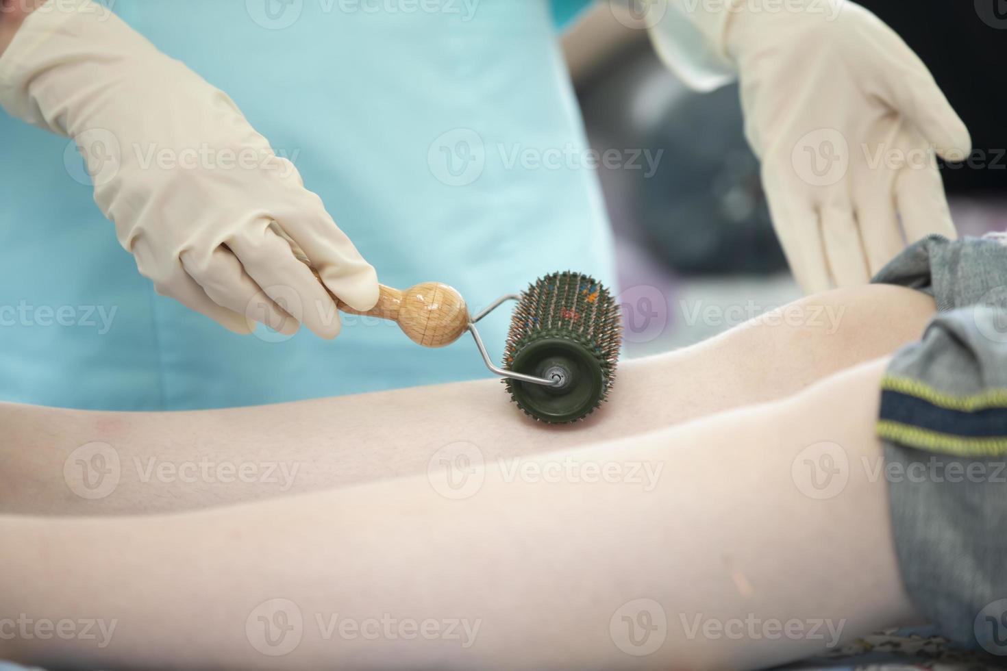de dokter maakt de geduldig acupunctuur en vacuüm massage. foto