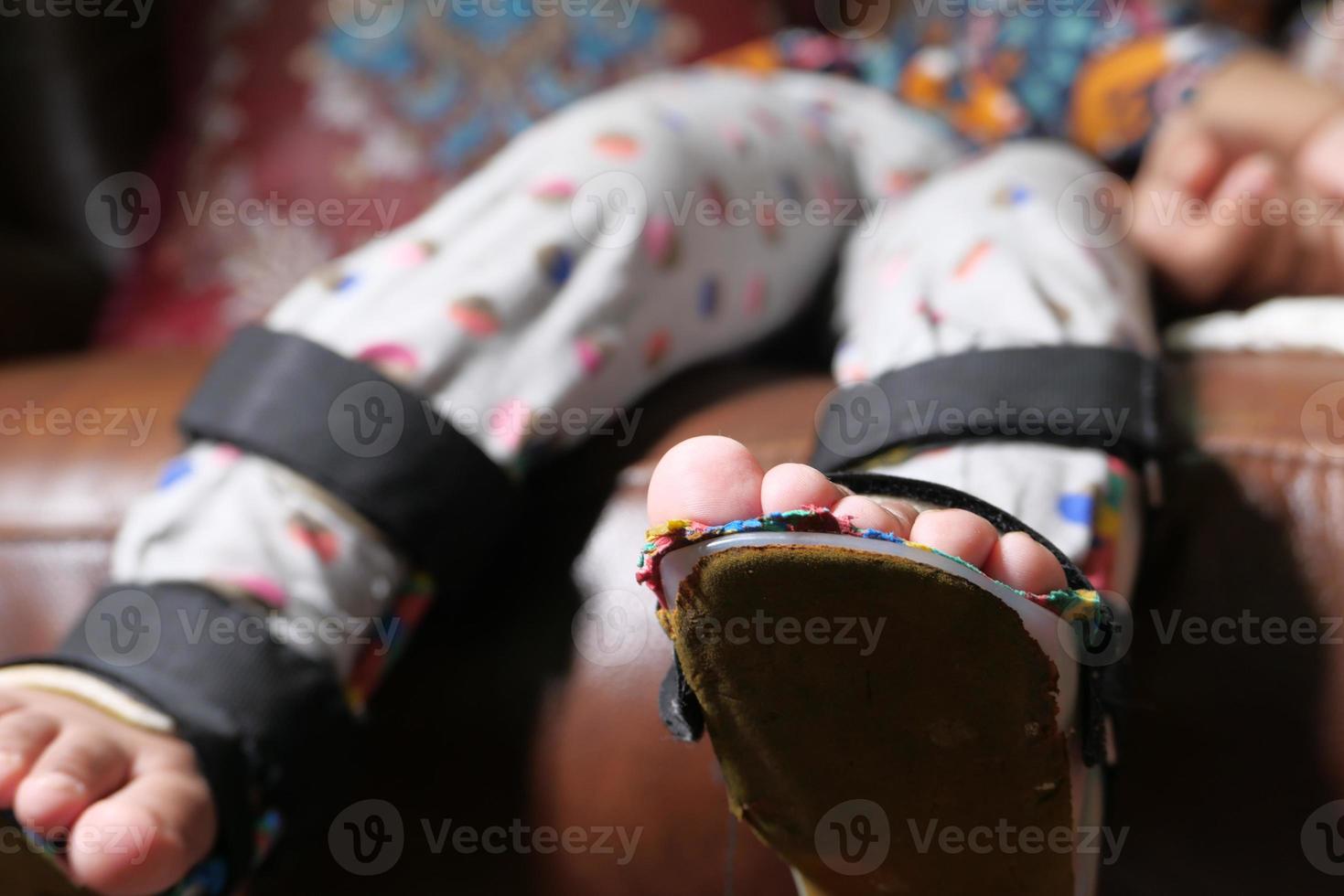 tenen van het kind met een handicap foto