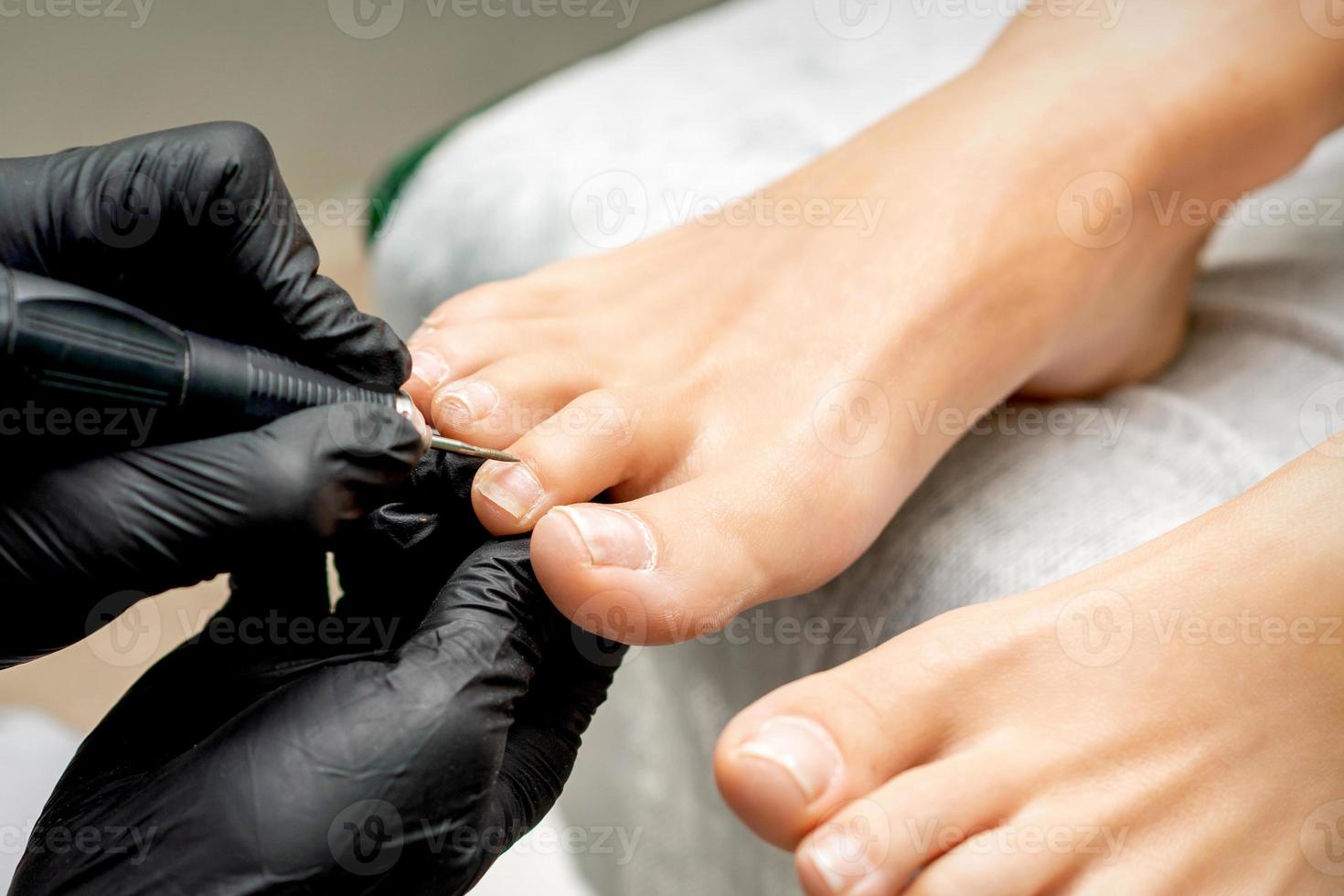 pedicure verwijdert nagelriem van tenen foto