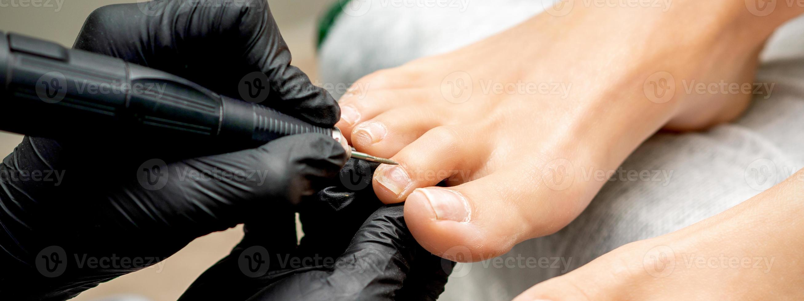 pedicure verwijdert nagelriem van tenen foto