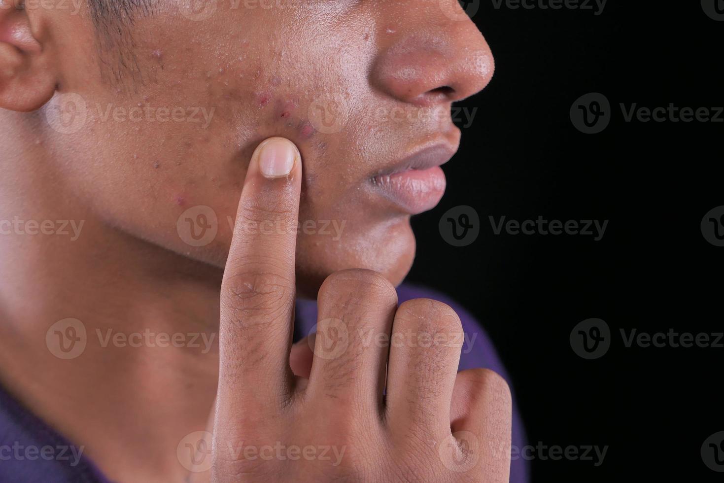 close-up van de jonge man die naar het gezicht wijst foto