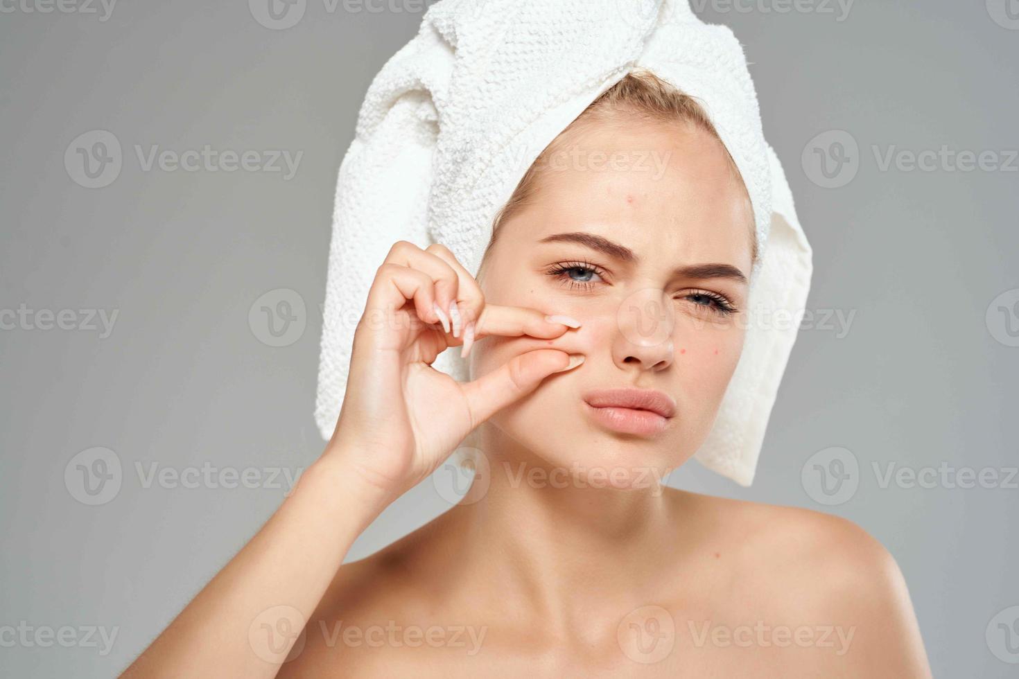 vrouw met kaal schouders en een handdoek Aan haar hoofd puistjes Aan haar gezicht detailopname foto